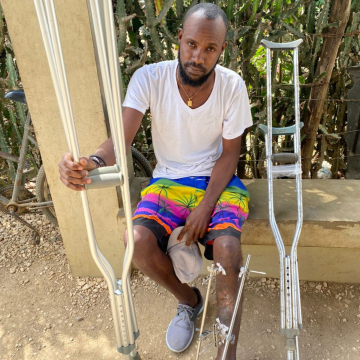 Watson sitting down with crutches and a brace on his leg